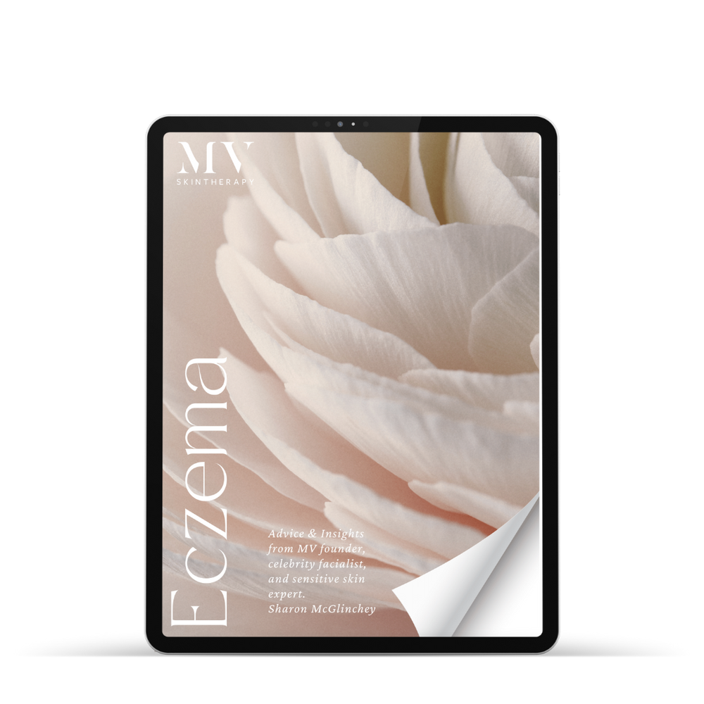 free Eczema eBook